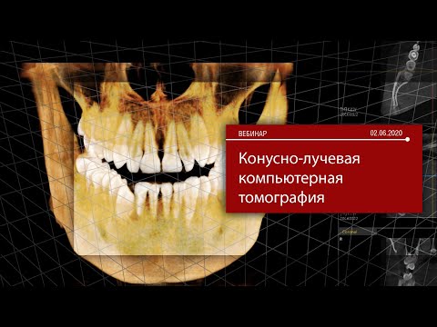 Видео: Конусно-лучевая компьютерная томография