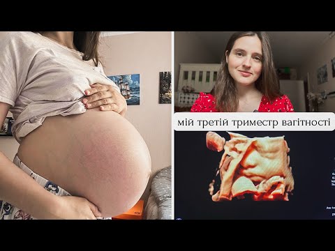 Видео: БАГАТОВОДДЯ | ПІДГОТОВКА до ПОЛОГІВ І скільки КГ набрала за ВАГІТНІСТЬ