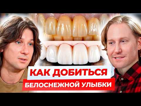 Видео: БЕЛЫЕ зубы БЕЗ вреда для здоровья! / Стоит ли устанавливать виниры?