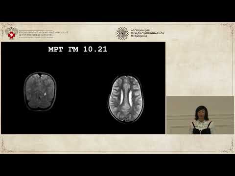 Видео: ЭПИЛЕПСИЯ 2023, дело 3: Восточный экспресс