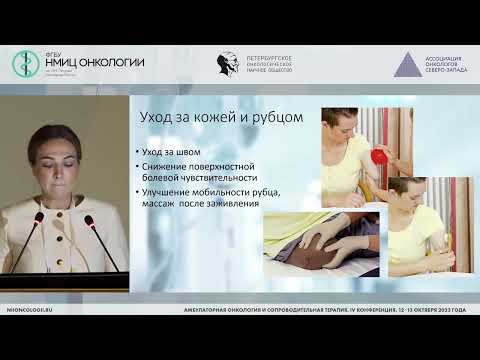 Видео: Реабилитация после ампутации конечности