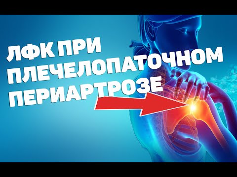 Видео: ЛФК при плечелопаточном периартрозе [период устойчивой ремиссии]