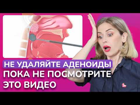 Видео: Удаление аденоидов НЕ ПОМОЖЕТ! Что делать после удаления аденоидов у детей?