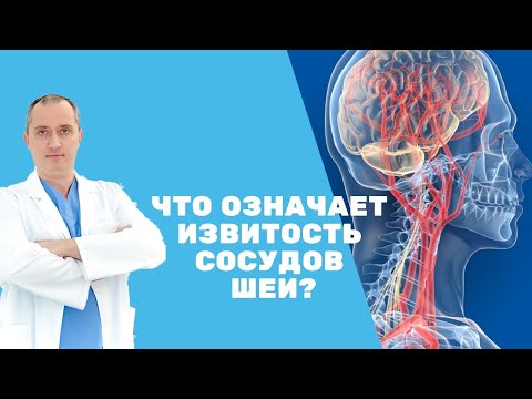 Видео: Что означает извитость сосудов шеи?