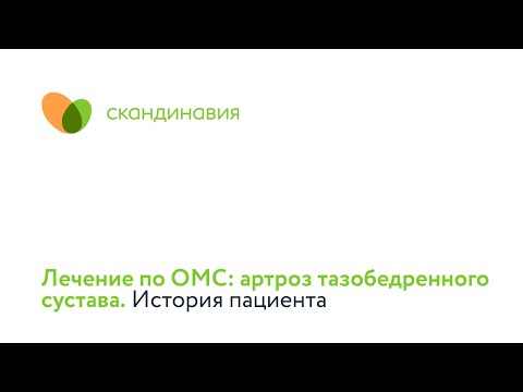 Видео: Лечение по ОМС: артроз тазобедренного сустава. История пациента.