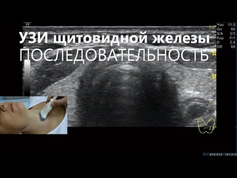 Видео: УЗИ щитовидной железы  Последовательность УЗИ щитовидной железы.