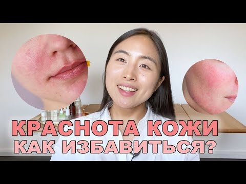 Видео: КАК ИЗБАВИТЬСЯ ОТ КРАСНОТЫ КОЖИ? НЕСКОЛЬКО ЛАЙФХАКОВ