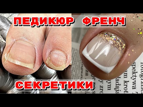 Видео: СЕКРЕТЫ ПЕДИКЮРА 😍 Педикюр после зимы 🦶Отросшие ногти