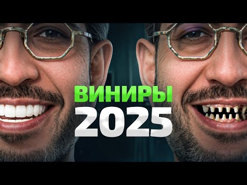 Видео: Никогда так НЕ делай! Ошибки установки виниров в 2025 году