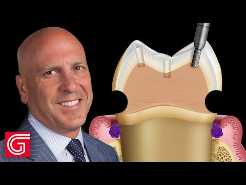 Видео: КАК ПОДГОТОВИТЬ МОЛЯР, ИСПОЛЬЗУЯ ТЕХНИКУ ОБРАЩЕНИЯ