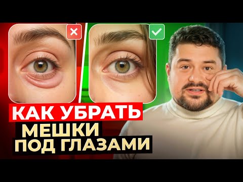 Видео: Почему появляются мешки под глазами и как их убрать быстро