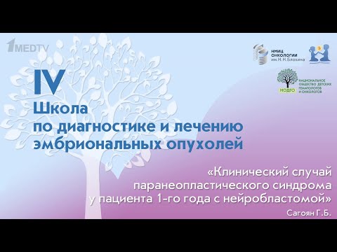 Видео: Сагоян Г.Б. - Паранеопластический синдром у пациента 1-го года с нейробластомой