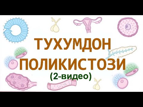 Видео: ТУХУМДОН ПОЛИКИСТОЗИ (2-ВИДЕО)
