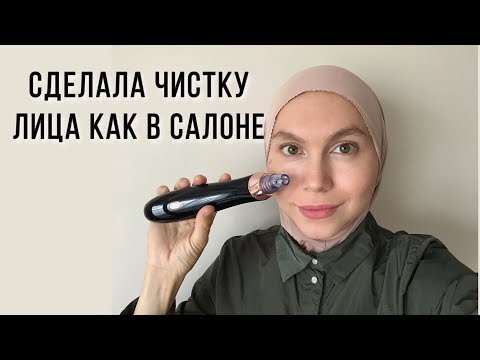 Видео: Как очистить поры и избавиться от черных точек. Вакуумная чистка лица