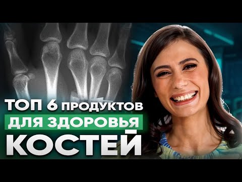 Видео: Ешь ЭТО и КОСТИ БУДУТ как в 20 ЛЕТ | Что ОПАСНО для костей и как их восстановить?