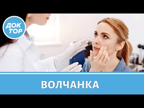 Видео: Как жить с системной красной волчанкой