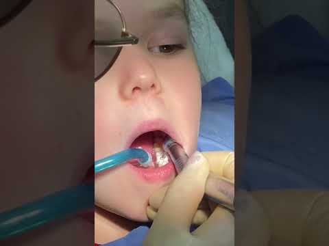 Видео: Супер зубной врач.Как всегда на высоте