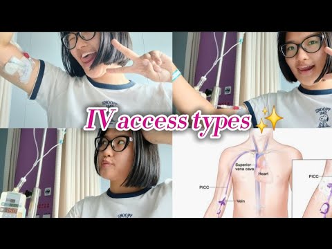 Видео: 🏥Хавдарын эмчилгээний уян зүүнүүд💁‍♀️| IV access types 💉🔴  (CVC, Port, PICC line)