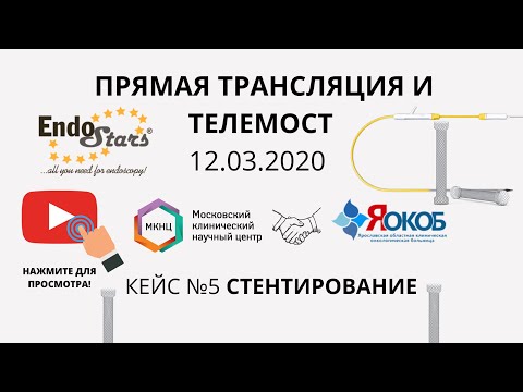 Видео: Стентирование, телемост МКНЦ-ЯОКОБ 12.03. Клинический случай №5.