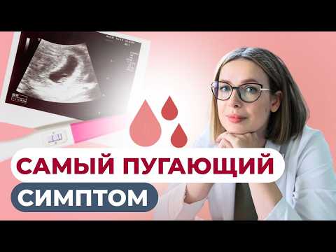 Видео: Все про кровянистые выделения во время беременности. Когда паниковать?