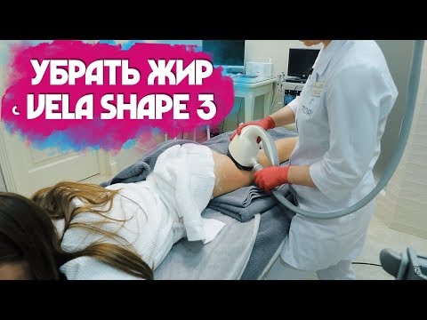 Видео: Коррекция фигуры без липосакции. Аппарат Vela Shape 3