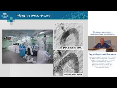 Видео: Массивная кровопотеря при травме Петриков СС