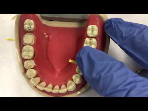 Видео: Секционная матричная система