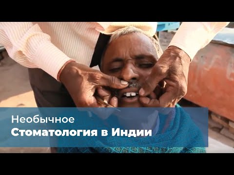 Видео: Стоматология в Индии