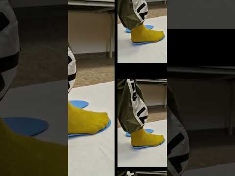Видео: Изготовление индивидуальных ортопедических стелек #shorts