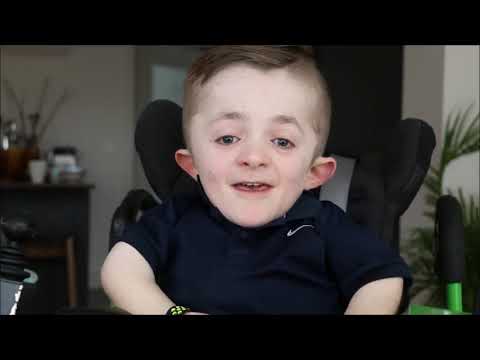 Видео: Майкл - болезнь "Хрустального человека" | Озвучено Metal Voice