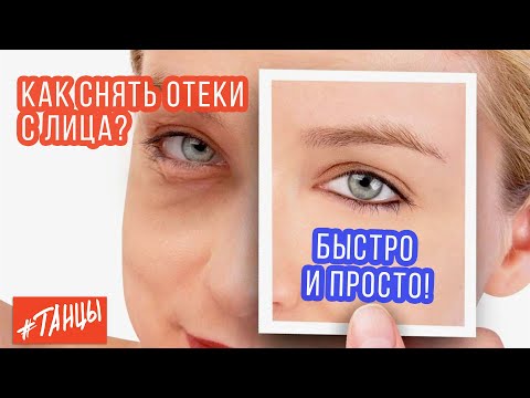 Видео: Как избавиться от отеков на лице. Экспресс-метод от Ксении Корнейчук