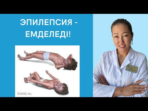 Видео: Эпилепсия деген қандай ауру? Тырысқақ ауруы. Түрлері. Емі.