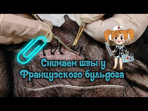 Видео: Как снять швы самостоятельно/Шов после кесарева / Таким  же образом снимают любые швы./Снятие шва