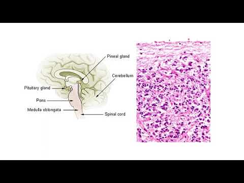 Видео: Епифиза – Corpus pineale (4:37) ┃teoriyata.com