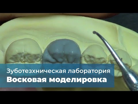 Видео: Восковая моделировка нижнего шестого зуба на учебной модели