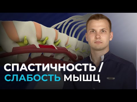 Видео: Спастичность и слабость мышц: как различить и лечить?