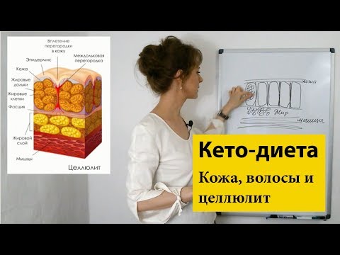 Видео: Кожа и целлюлит