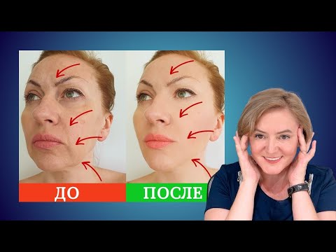 Видео: Омоложение Лица После 40 лет