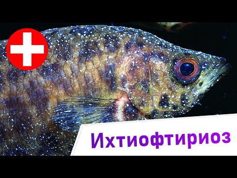 Видео: Ихтиофтириоз - Лечение