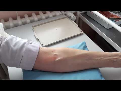 Видео: 024. Введение препарата "на крови". Как разводить?