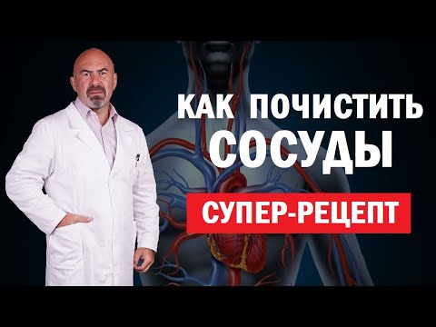 Видео: ❤️ КАК ПОЧИСТИТЬ СОСУДЫ. Супер рецепт для сосудов - как почистить сосуды в домашних условиях