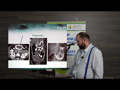 Видео: 52. Стомашни трихобезоари в детска възраст – диагностично и терапевтично предизвикателство.