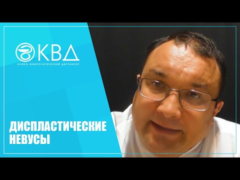 Видео: 1350  Диспластические невусы