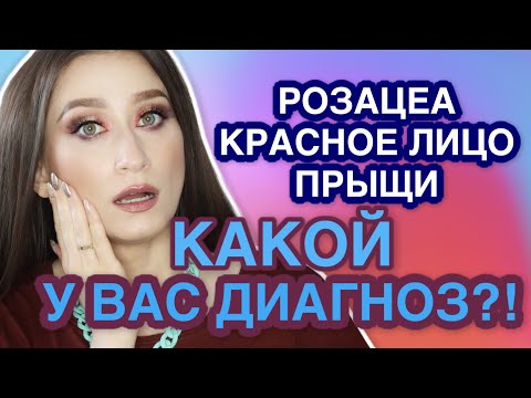 Видео: РОЗАЦЕА, АКНЕ, ДЕМОДЕКОЗ, ДЕРМАТИТ: ищем отличия❗️