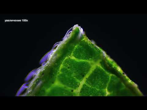 Видео: Ожог крапивой - как быстро снять зуд? Крапива под микроскопом