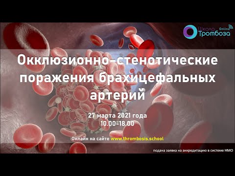 Видео: Школа Тромбоза "Окклюзионно-стенотические поражения брахицефальных артерий" (27.03.2023)