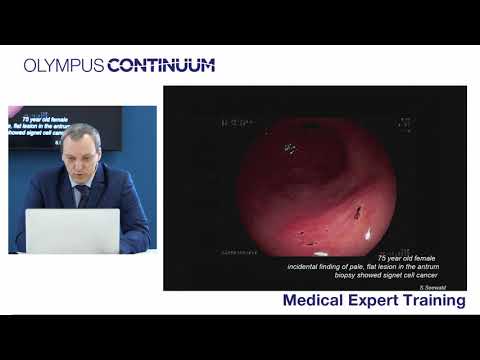 Видео: Особенности подслизистой диссекции в желудке — Вдадислав Яковенко