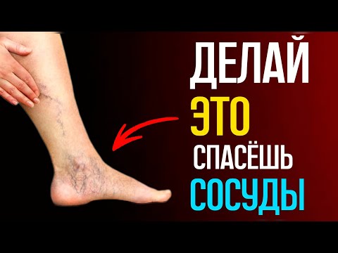 Видео: Увеличиваем кровообращение в ногах! Пройдёт боль, судороги, холод в ногах.