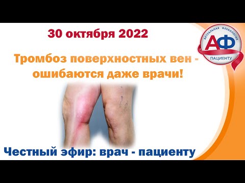 Видео: 15 минут о тромбозе поверхностных вен - ошибки врачей