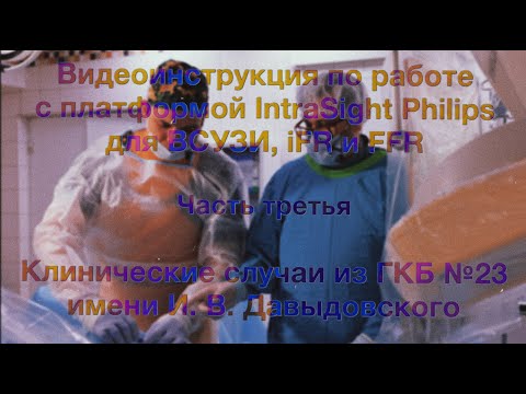 Видео: Клинические случаи из ГКБ №23 с демонстрацией работы на платформе IntraSight Philips